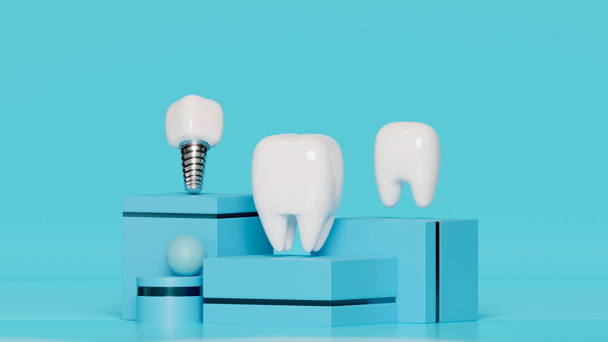 How Long Do Dental Implants Last? Factors That Affect Longevity
